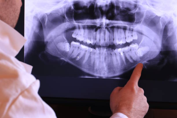 Best Emergency Denture Repair in Hamilton College, NY