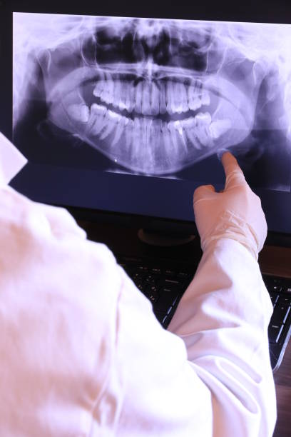 Best Emergency Dental Care for Broken or Chipped Teeth in Hamilton College, NY